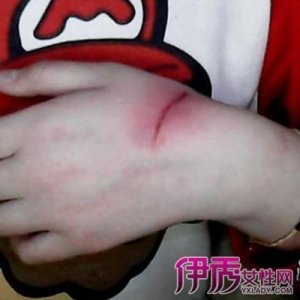 ​手把手教你画简单的伤口 13步画超逼真假伤口让你胆寒