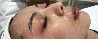 ​皮肤分几类