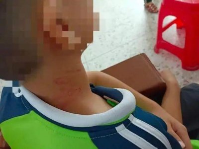 ​学生忘戴红领巾被校长掐脖追打？当地教育局：已介入调查