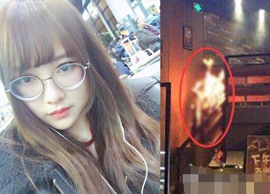 snh48唐安琪意外烧伤（SNH48女团烧伤成员唐安琪发文）(2)