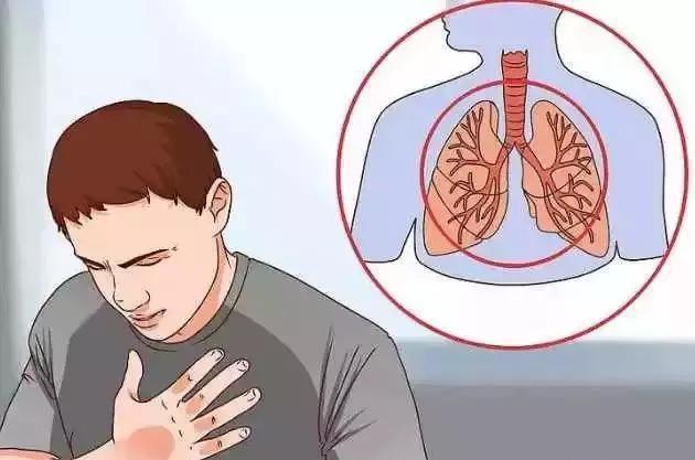 肺癌不是悄无声息,手上出现2种标记,最好查一下肺CT