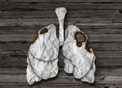 ​肺癌不是悄无声息，手