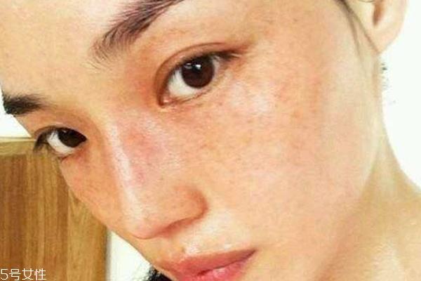 雀斑多怎么化妆自然 雀斑妹子7个化妆技巧 雀斑多怎么化妆自然 雀斑妹子7个化妆技巧