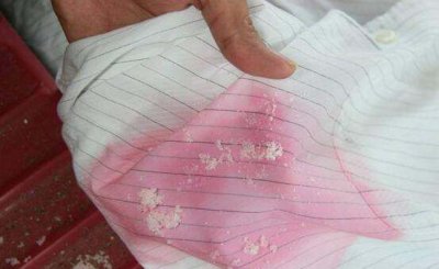 ​怎么洗杨梅汁染色的衣