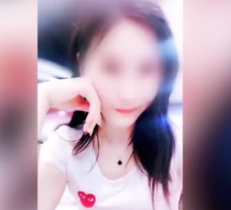 ​女主播网购染发剂中毒 满头秀发脱落变板寸 商家称自身体质问题