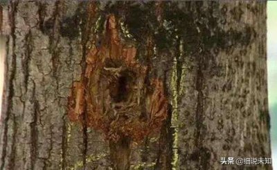 ​世界上最倒霉的这几个人，不要总抱怨生活的不幸，看看这几个人