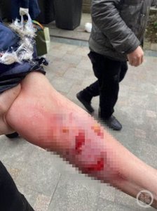 ​女子在小区电梯内被狗咬伤！警方回应