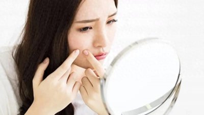 ​痘痘挤了还长，还越变