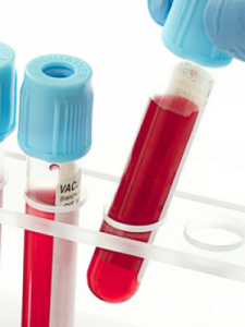 ​tdm是什么意思