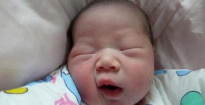 ​女子生出无眼婴儿 什么